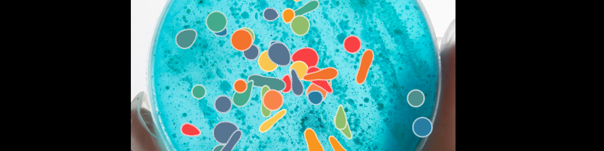 WCCChallenge 2025 Week 15 - Petri Dish